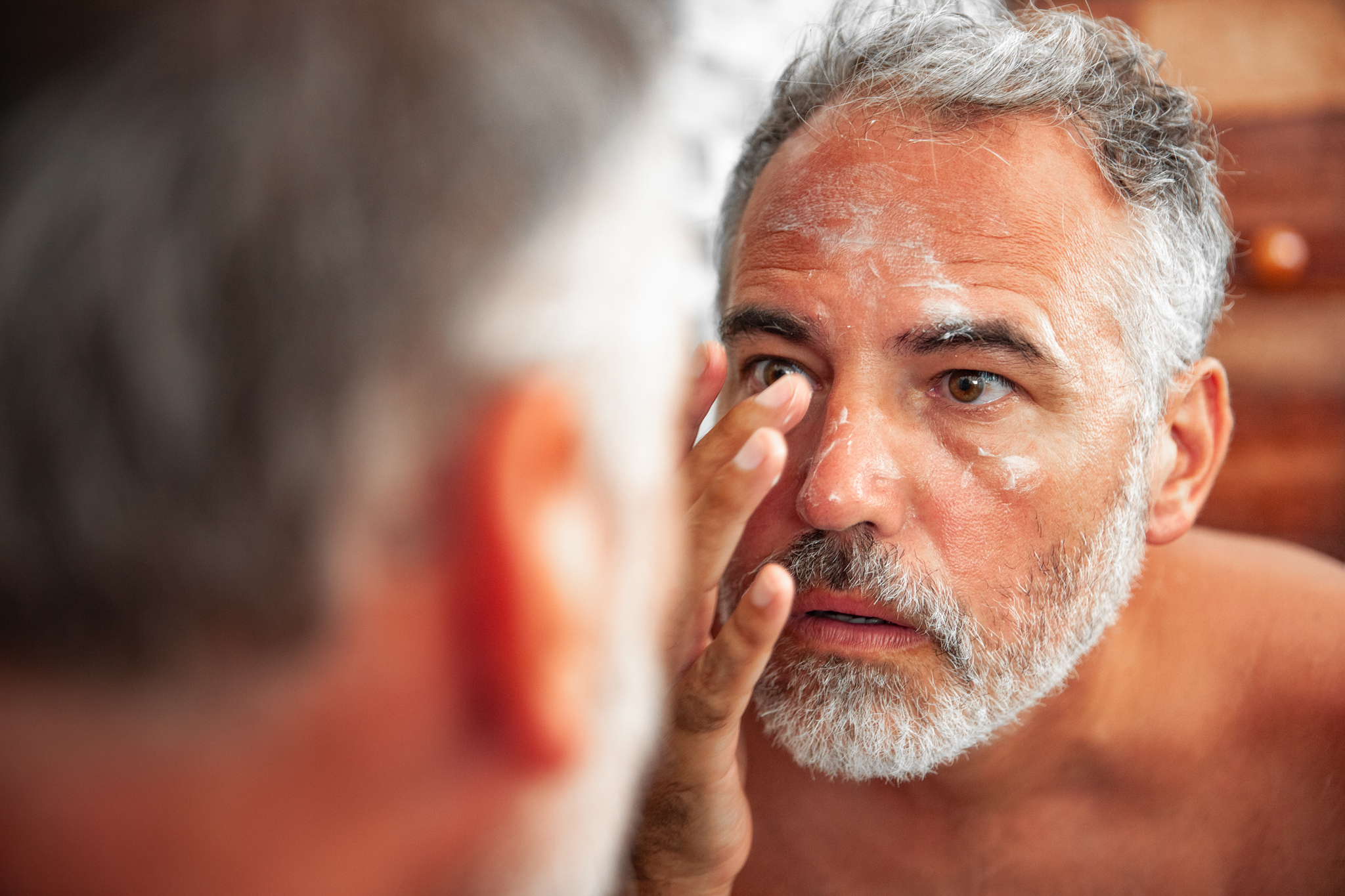 older man with sunburn