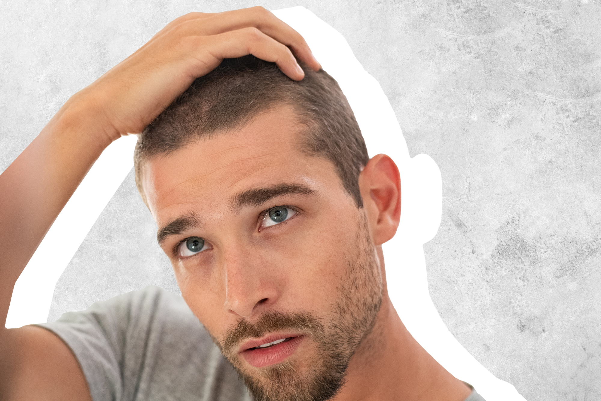 12 Ways to Treat Male Pattern Hair Loss  wikiHow