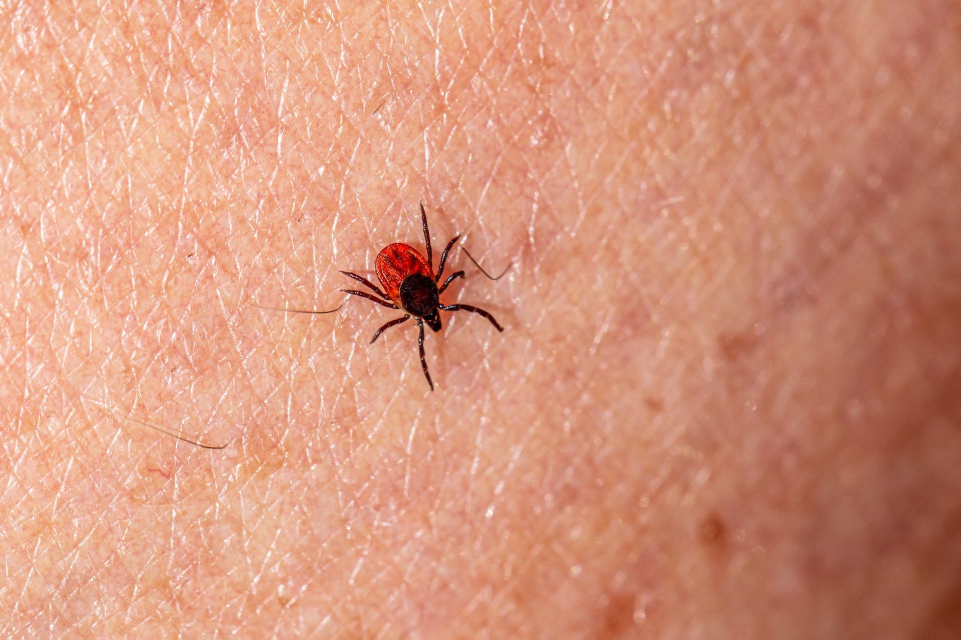 A tick hanging out on human skin